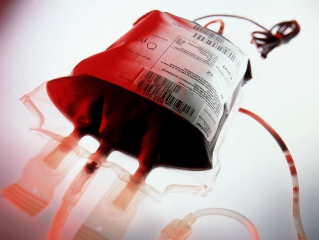 Trasfusione con sangue infetto: maxi-risarcimento agli eredi