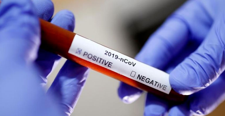 Coronavirus, in Abruzzo 122 casi positivi in più rispetto a ieri