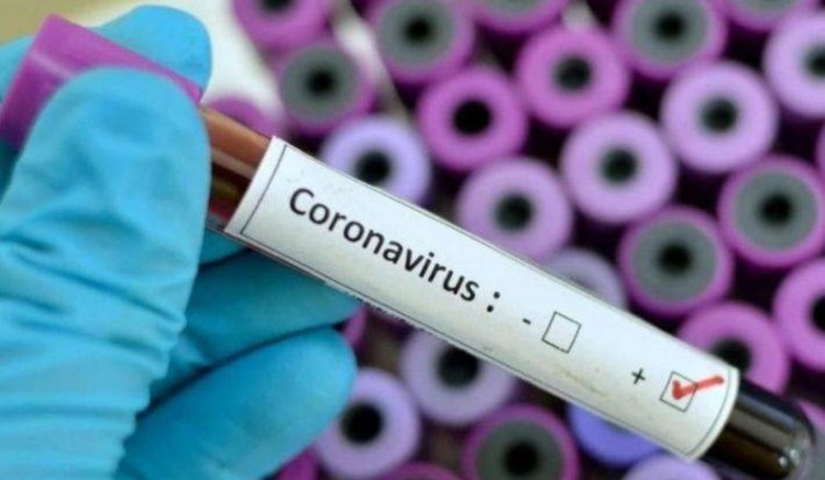 Coronavirus in Abruzzo, positivi a 3086, si registra un aumento di 8 casi