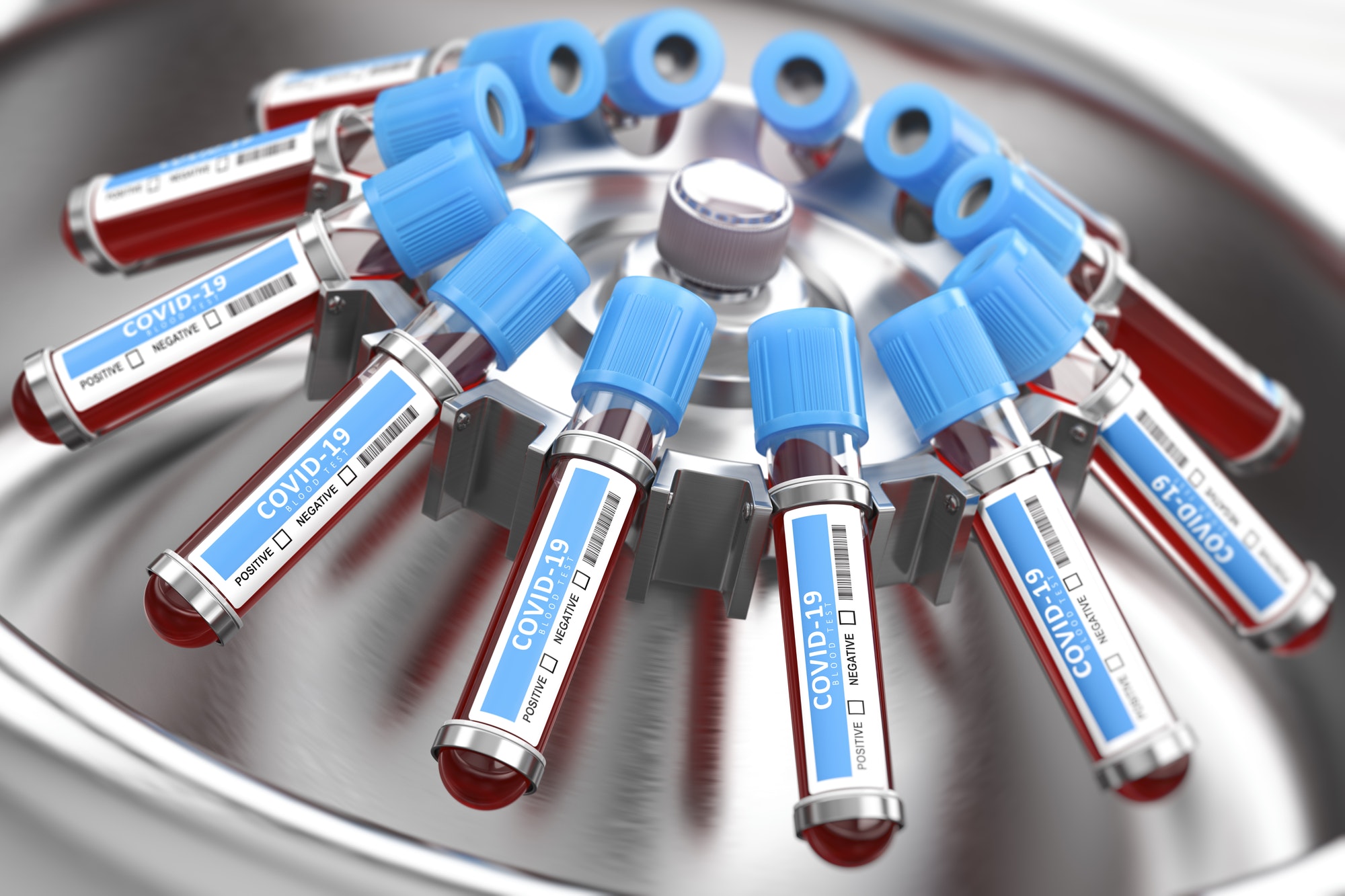Coronavirus COVID-19 blood test samples tubes in centrifuge. Diagnostic medical laboratory.