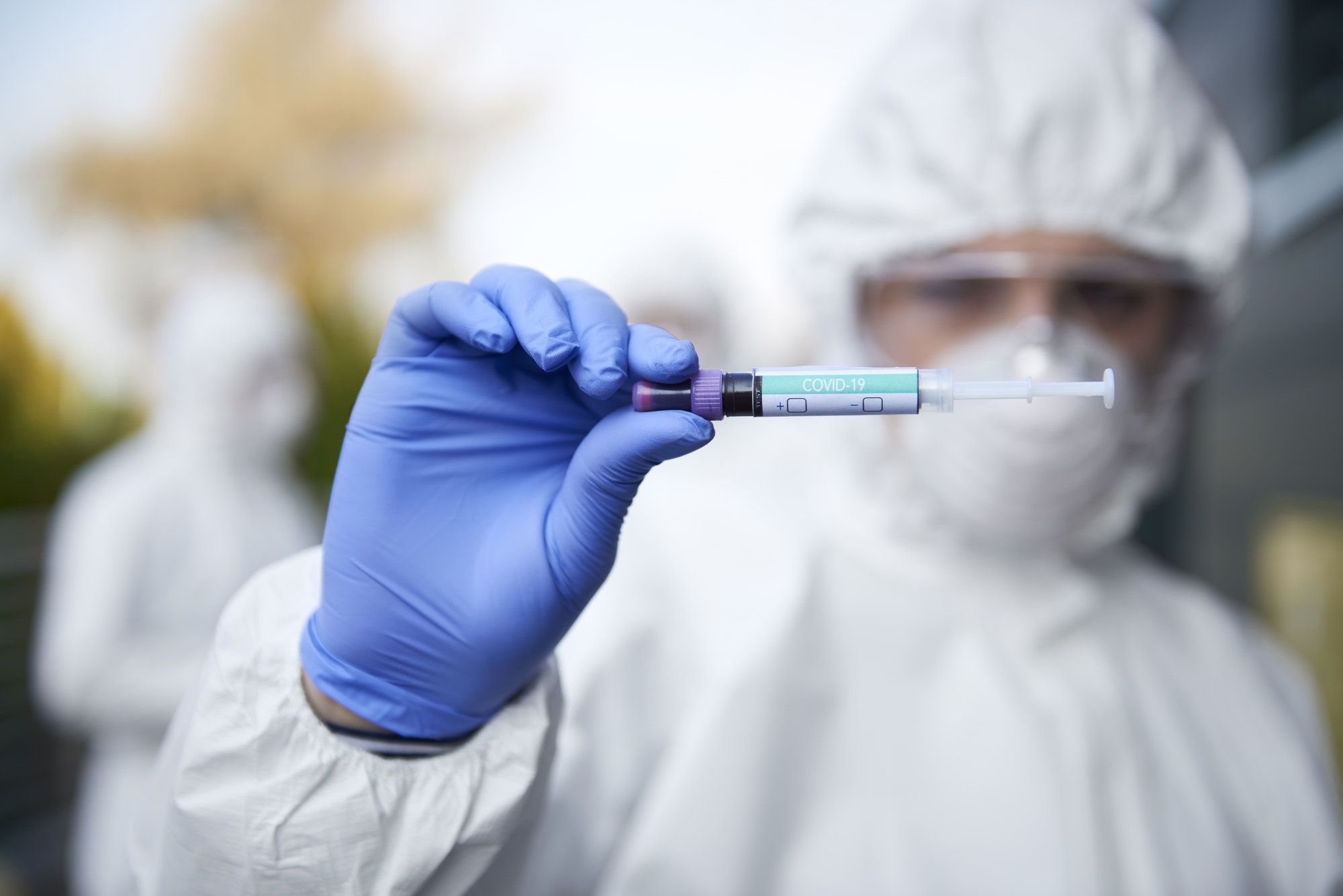 Technician holding a coronavirus test