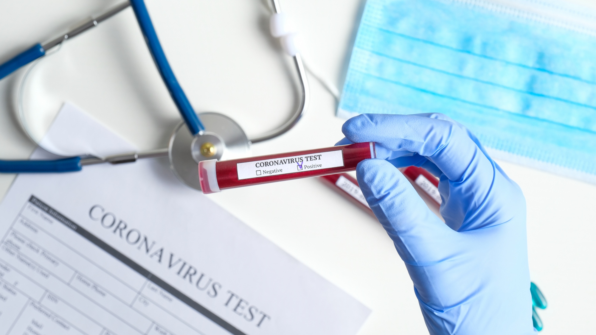 Coronavirus in Abruzzo, positivi a 3267, si registra 1 nuovo caso su un totale di 1295 tamponi analizzati