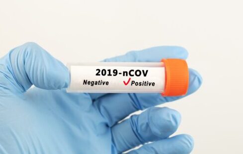 Coronavirus testing