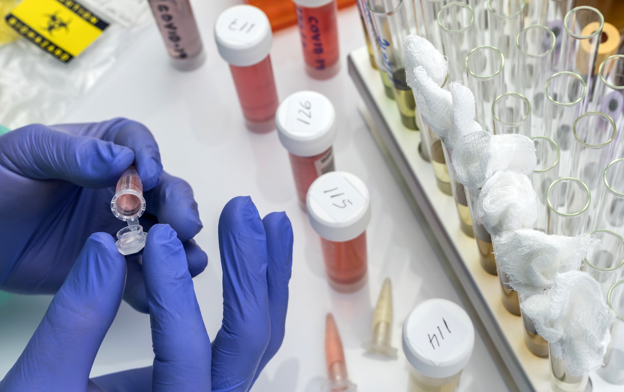 Scientist examines sample of coronavirus in laboratory, conceptual image