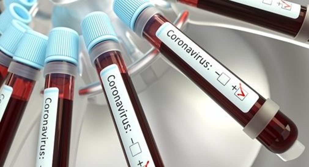 Coronavirus in Abruzzo, positivi a 33101. Rispetto a ieri si registrano 227 nuovi casi