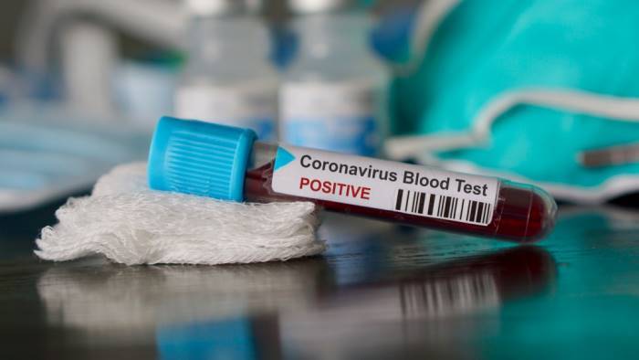 Coronavirus in Abruzzo, positivi a 21842. Rispetto a ieri si registrano 649 nuovi casi 