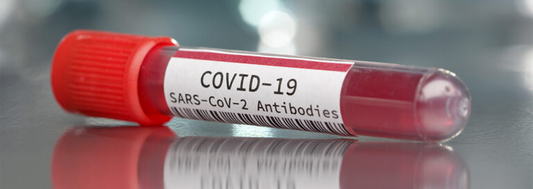 COVID-19-Antibodies