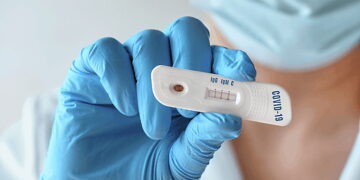 Test antigenici anti Covid gratuiti per la popolazione di Pereto sabato 10 luglio