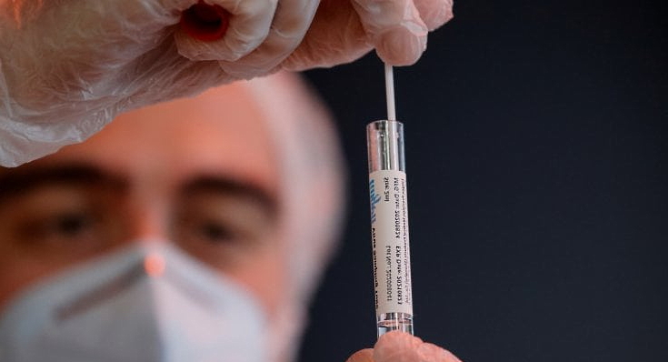 Test antigenici rapidi saranno eseguiti anche dai medici di famiglia