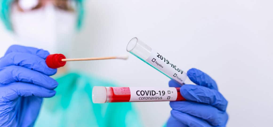 Coronavirus in Abruzzo oggi 13 nuovi positivi