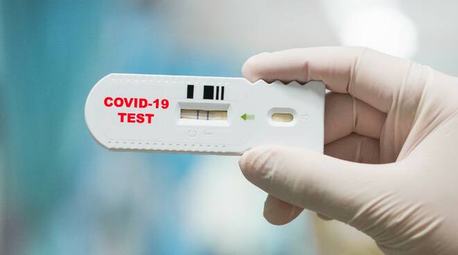Test antigenico rapido gratuito per la popolazione di Pereto nella giornata di domenica 21 febbraio