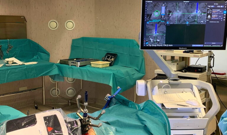L'Aquila: intervento neurochirurgico con robot tra i primi in Italia, prelevato tessuto cerebrale su tumore profondo