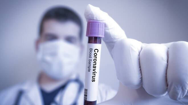 coronavirus