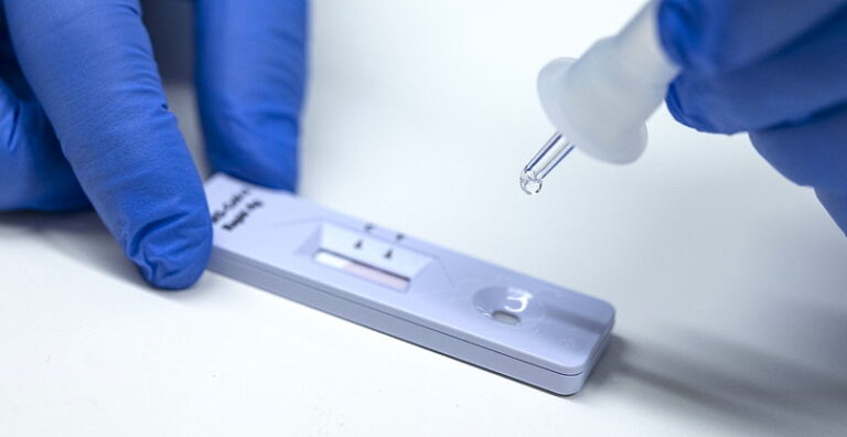 Test antigenici rapidi a prezzi calmierati anche in strutture sanitarie private