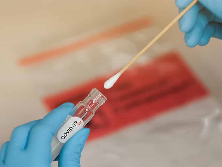 Coronavirus: stop al molecolare di conferma per il test antigenico positivo