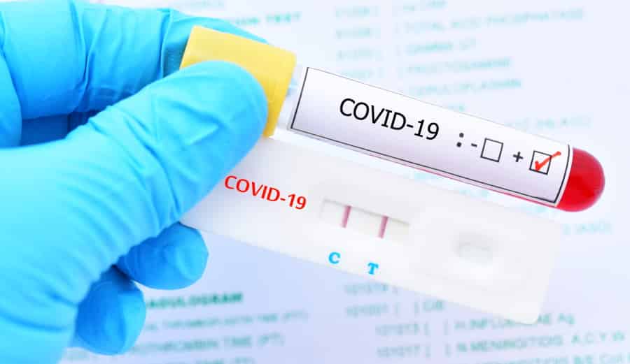 Coronavirus in Abruzzo, oggi 3619 nuovi positivi e 5 deceduti