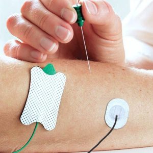 Ospedale di Avezzano senza elettromiografo: servizio essenziale per valutare lo stato di salute di nervi, muscoli e diagnosticare SLA, SMA e altre patologie