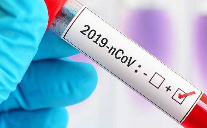 Tre nuovi casi Covid-19 a Sante Marie. Il totale dei positivi è di 10