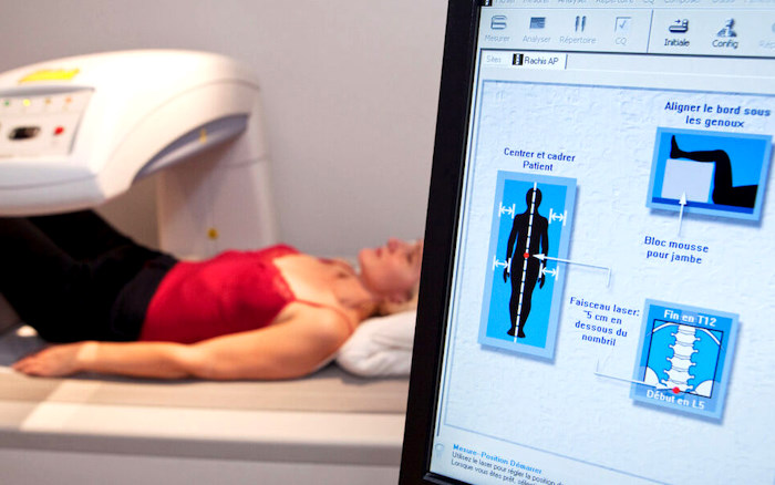Ripartono le prenotazioni al Cup della Asl 1 per effettuare la Moc. Il Pta di Pescina pronto ad accogliere altre specialità radiologiche